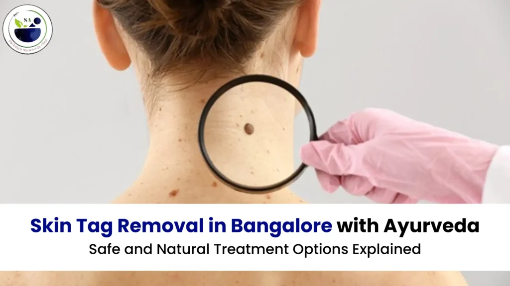 Skin Tag Removal in Bangalore